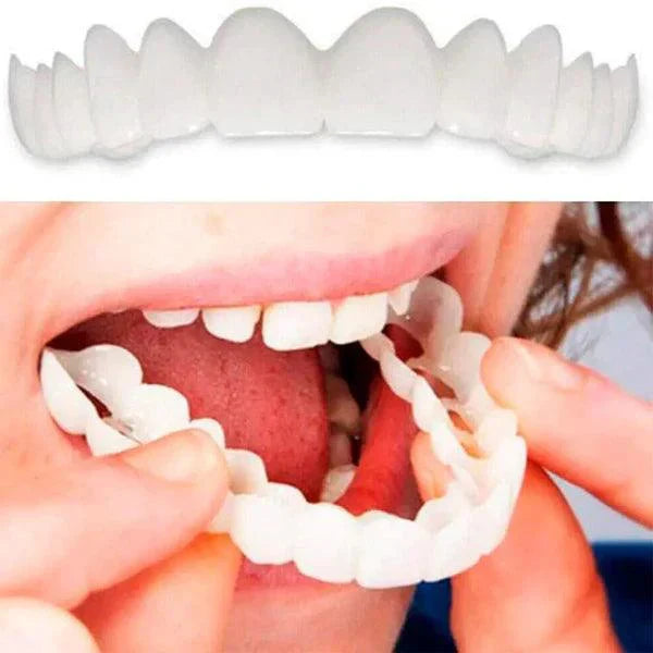 SMILE PRO® – WYJMOWANE LICÓWKI DENTYSTYCZNE | DOLNE I GÓRNE